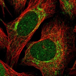 HNRPLL Antibody, Novus Biologicals 0.1mL; Unlabeled:Antibodies, Polyclonal